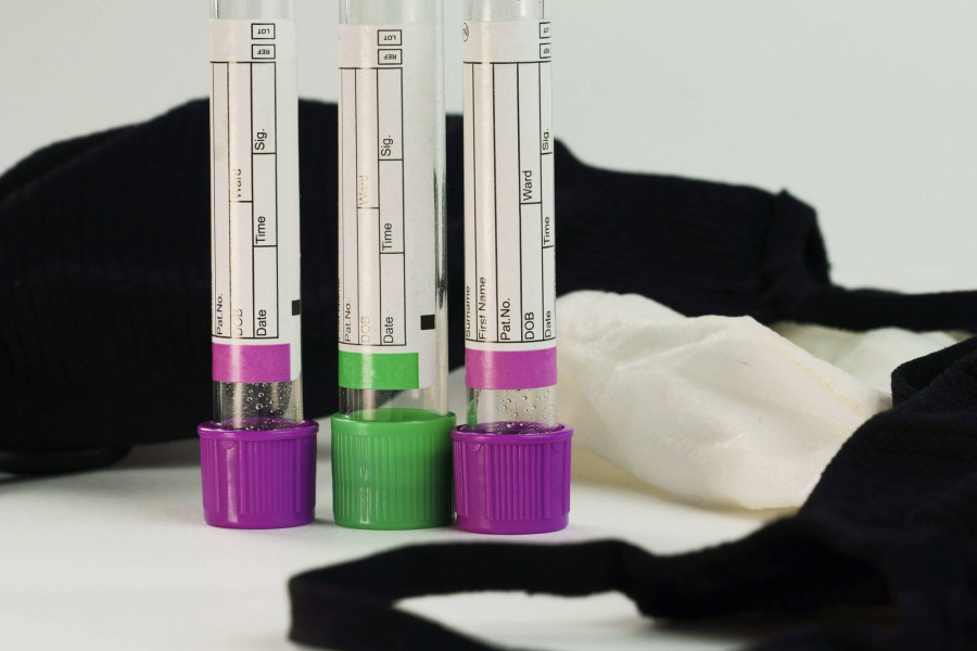 Gospodarka hormonalna jakie badania pomogą wykryć zaburzenia